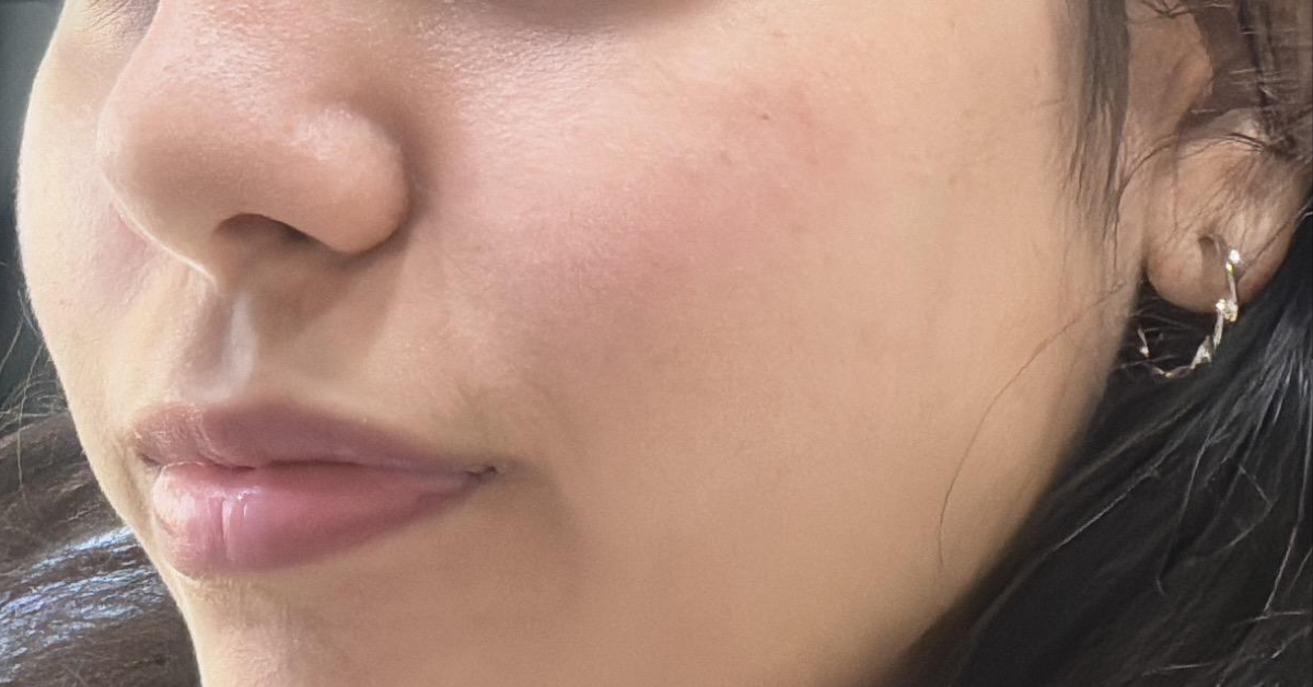 cleanser for acne prone skin by twenty seven skincare