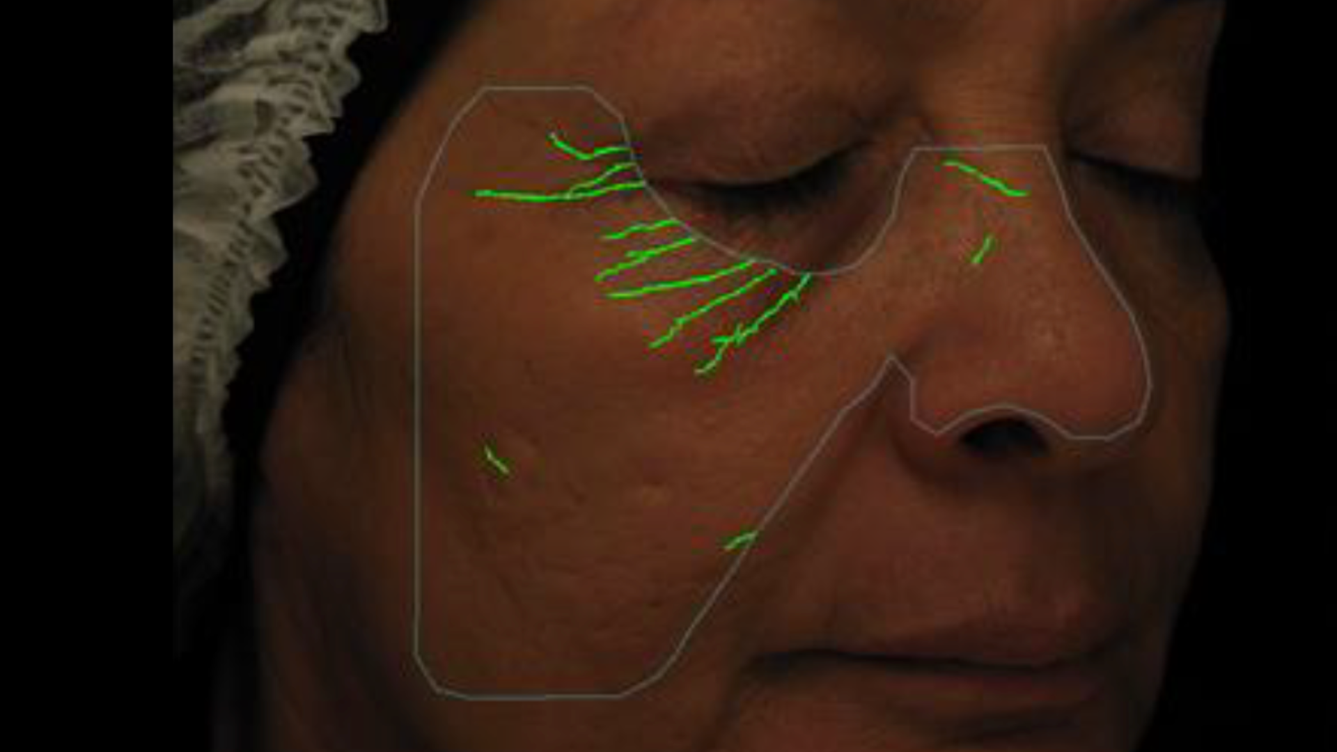 reduce wrinkles and fine lines