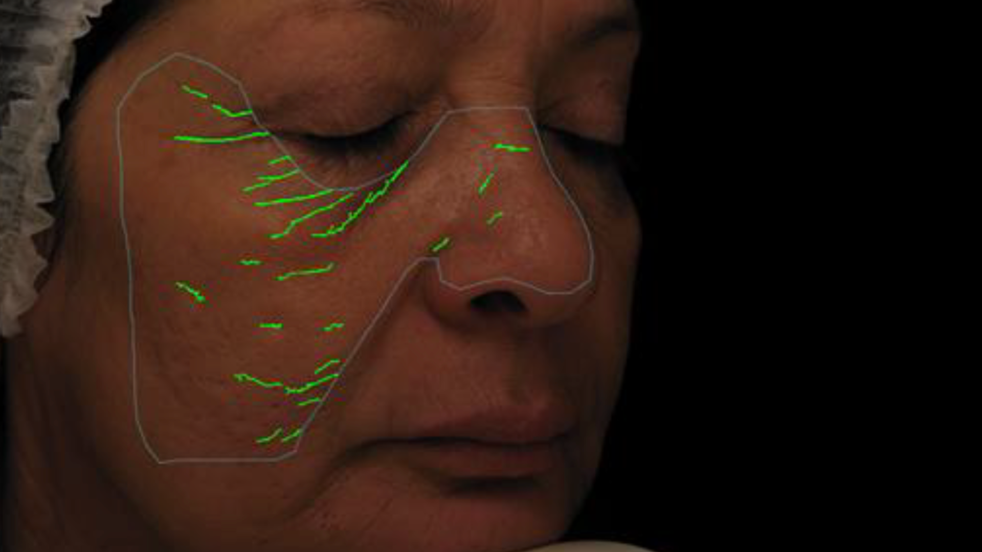 reduce wrinkles and fine lines