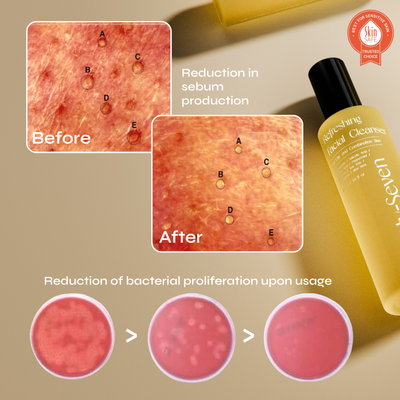 Nettoyant rafraîchissant pour le visage à la niacinamide, à l'acide salicylique et à l'acide glycolique (AHA)